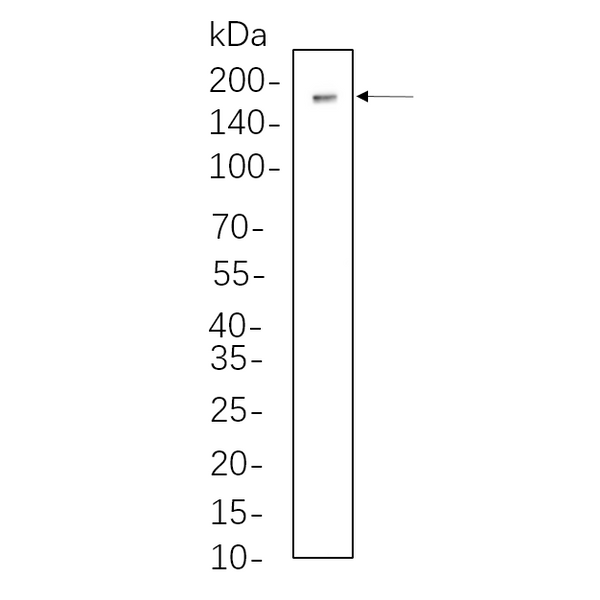 U-Blot® DNMT1 Rabbit Monoclonal Antibody – Figure 1 of 1