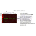 U-Blot® β3 Tubulin Rabbit Monoclonal Antibody – Figure 1 of 2