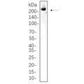 U-Blot® ALK Rabbit Monoclonal Antibody – Figure 1 of 1