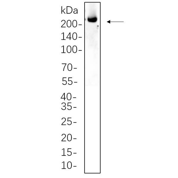 U-Blot® ALK Rabbit Monoclonal Antibody – Figure 1 of 1