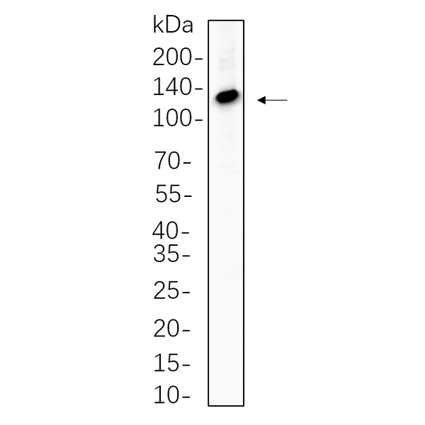 U-Blot® ATP-Citrate Lyase Rabbit Monoclonal Antibody – Figure 1 of 1