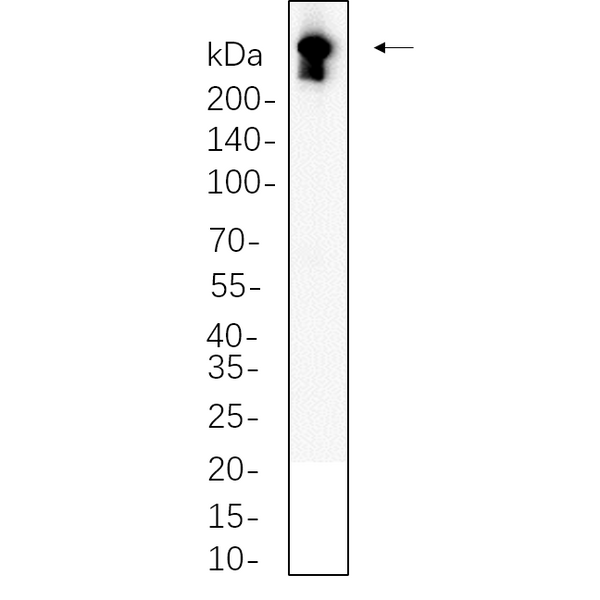 U-Blot® DNA PKcs Rabbit Monoclonal Antibody – Figure 1 of 1