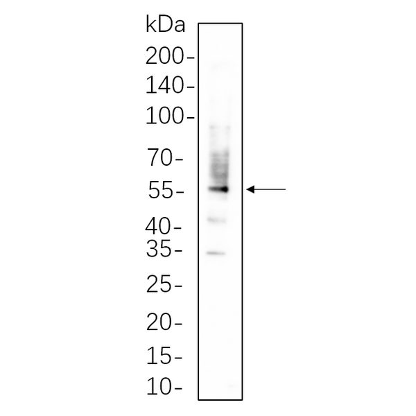 U-Blot® PDI Rabbit Monoclonal Antibody – Figure 1 of 1