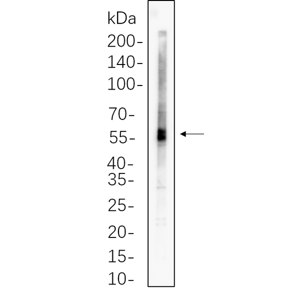 U-Blot® ATGL Rabbit Monoclonal Antibody – Figure 1 of 1