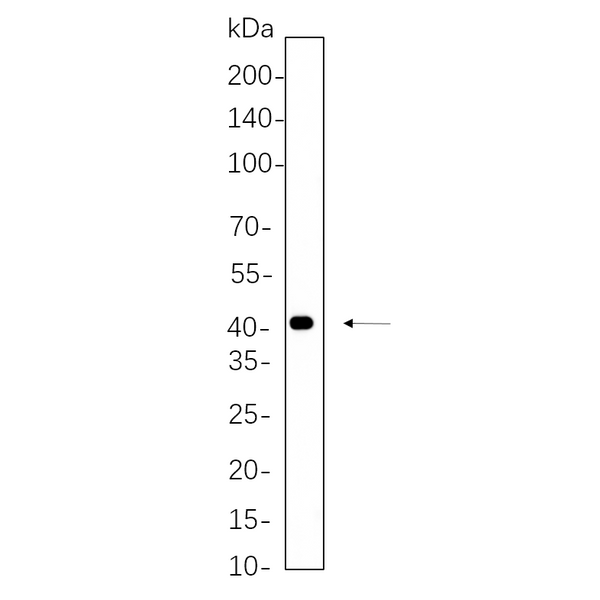 U-Blot® MEK4 Rabbit Monoclonal Antibody – Figure 1 of 1