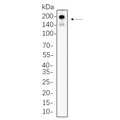 U-Blot® PDGFR-α Rabbit Monoclonal Antibody – Figure 1 of 1