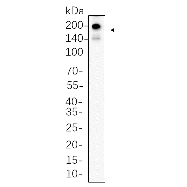 U-Blot® PDGFR-α Rabbit Monoclonal Antibody – Figure 1 of 1