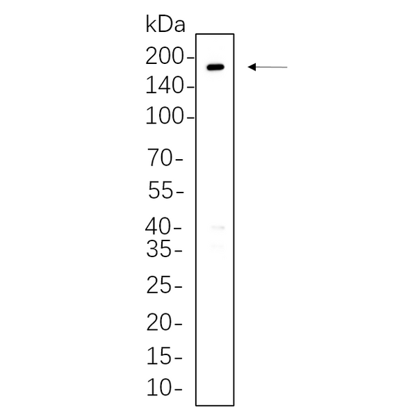 U-Blot® ErbB-3 Rabbit Monoclonal Antibody – Figure 1 of 1