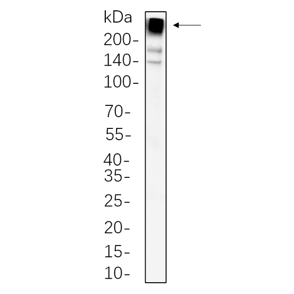 U-Blot® Acetyl Coenzyme A Carboxylase beta Rabbit Monoclonal Antibody – Figure 1 of 1