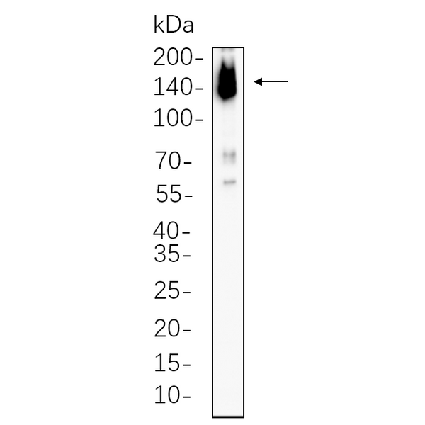 U-Blot® ASK1 Rabbit Monoclonal Antibody – Figure 1 of 1