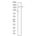 U-Blot® LATS1 Rabbit Monoclonal Antibody – Figure 1 of 1