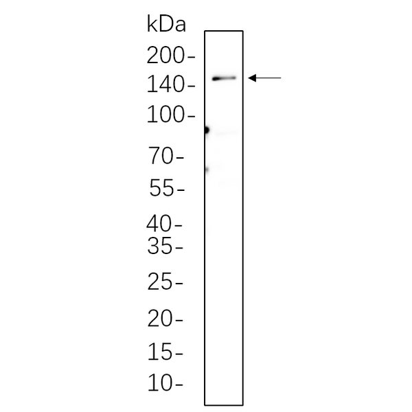 U-Blot® LATS1 Rabbit Monoclonal Antibody – Figure 1 of 1