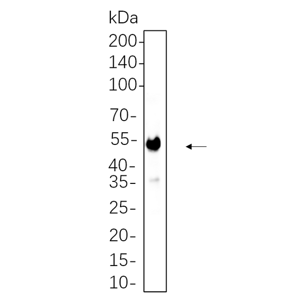 U-Blot® CaMKII α Rabbit Monoclonal Antibody – Figure 1 of 1
