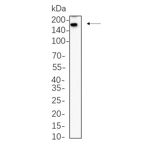 U-Blot® SALL4 Rabbit Monoclonal Antibody – Figure 1 of 1