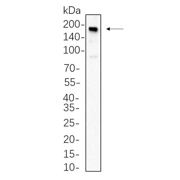 U-Blot® Met Rabbit Monoclonal Antibody – Figure 1 of 1