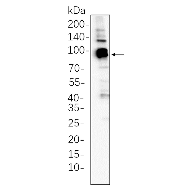 U-Blot® Ctip2 Rabbit Monoclonal Antibody – Figure 1 of 1