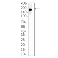 U-Blot® HER2 Rabbit Monoclonal Antibody – Figure 1 of 1