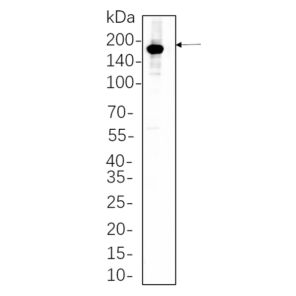 U-Blot® HER2 Rabbit Monoclonal Antibody – Figure 1 of 1