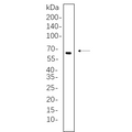 U-Blot® Estrogen Receptor α Rabbit Monoclonal Antibody – Figure 1 of 1