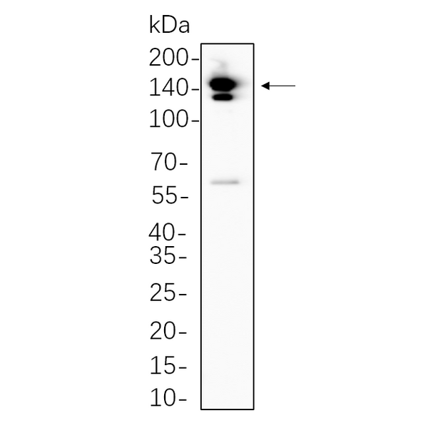 U-Blot® PYK2 Rabbit Monoclonal Antibody – Figure 1 of 1
