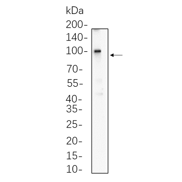 U-Blot® β Catenin (Phospho Thr41/Ser45) Rabbit Monoclonal Antibody – Figure 1 of 1