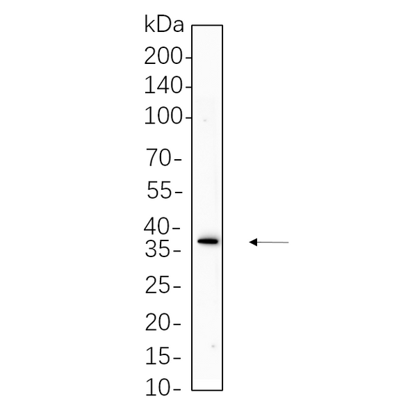U-Blot® Podoplanin Rabbit Monoclonal Antibody – Figure 1 of 1