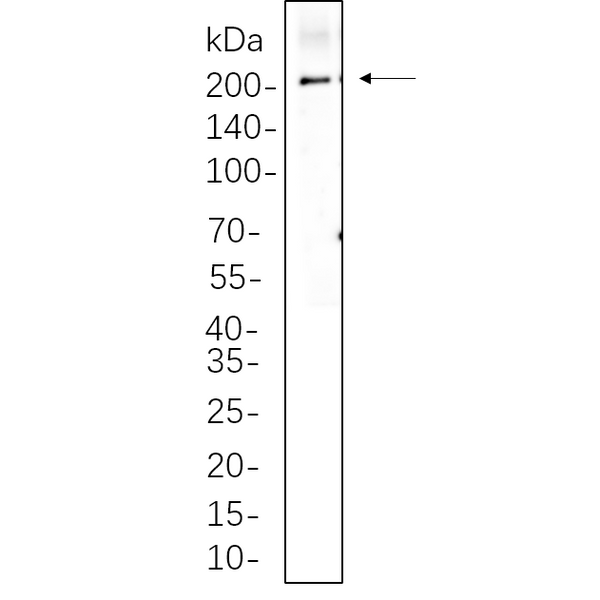 U-Blot® SPTBN1 Rabbit Monoclonal Antibody – Figure 1 of 1