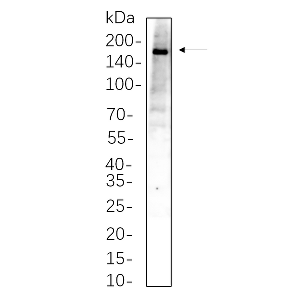 U-Blot® TBC1D4 Rabbit Monoclonal Antibody – Figure 1 of 1
