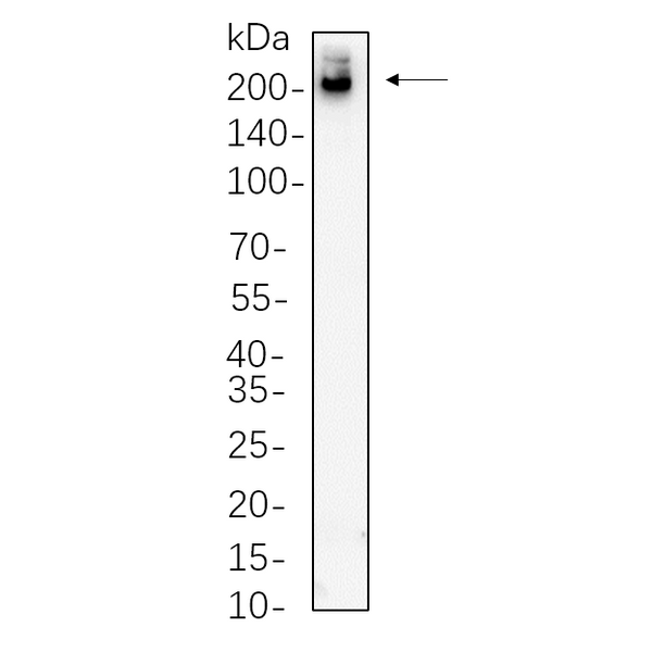 U-Blot® Clathrin Heavy Chain Rabbit Monoclonal Antibody – Figure 1 of 1