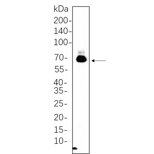 U-Blot® BACE Rabbit Monoclonal Antibody – Figure 1 of 1