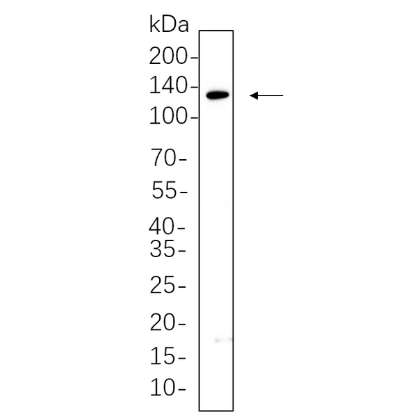 U-Blot® JAK1 Rabbit Monoclonal Antibody – Figure 1 of 1