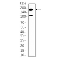 U-Blot® Rictor Rabbit Monoclonal Antibody – Figure 1 of 1