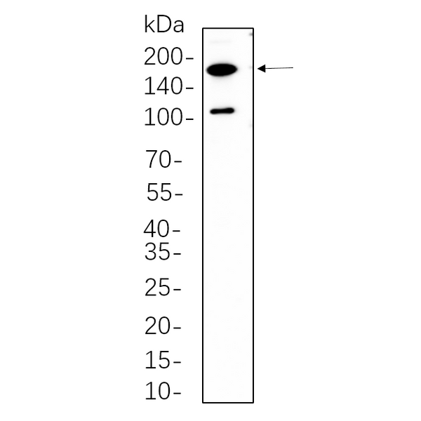 U-Blot® Rictor Rabbit Monoclonal Antibody – Figure 1 of 1