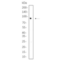 U-Blot® IFT88 Rabbit Monoclonal Antibody – Figure 1 of 1