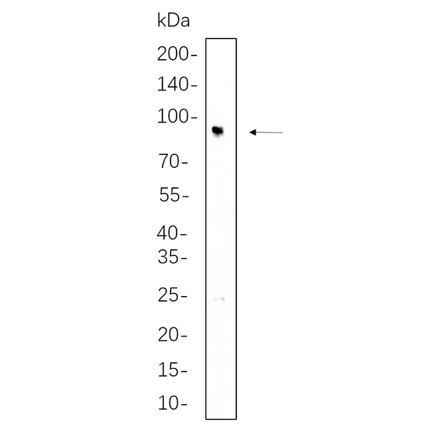U-Blot® IFT88 Rabbit Monoclonal Antibody – Figure 1 of 1
