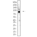 U-Blot® MDM2 Rabbit Monoclonal Antibody – Figure 1 of 1
