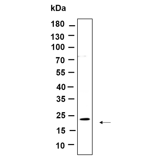 U-Blot® Cofilin Rabbit Monoclonal Antibody – Figure 1 of 1