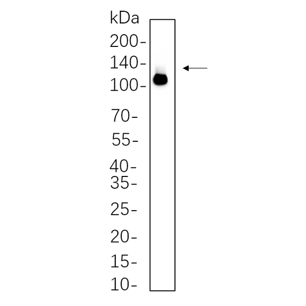 U-Blot® DDX58 Rabbit Monoclonal Antibody – Figure 1 of 1