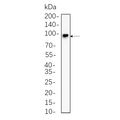 U-Blot® Insulin Receptor β Rabbit Monoclonal Antibody – Figure 1 of 1