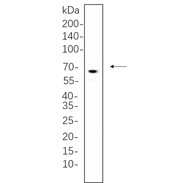 U-Blot® BTK Rabbit Monoclonal Antibody – Figure 1 of 1