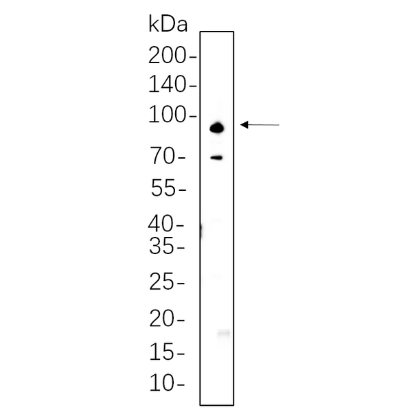 U-Blot® ADAM10 Rabbit Monoclonal Antibody – Figure 1 of 1