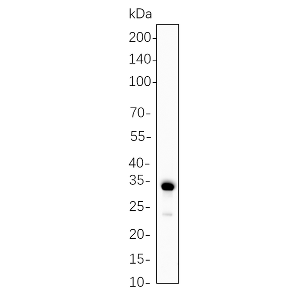 U-Blot® Calponin-1 Rabbit Monoclonal Antibody – Figure 1 of 1