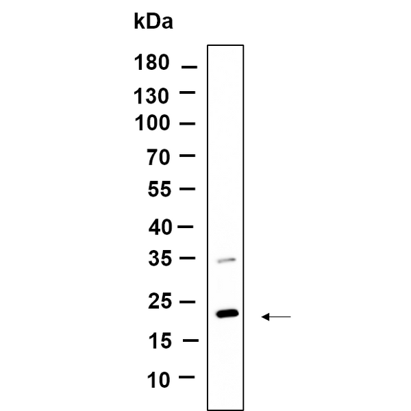 U-Blot® CD81 Rabbit Monoclonal Antibody – Figure 1 of 1