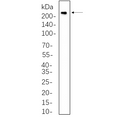 U-Blot® VEGF Receptor 2 Rabbit Monoclonal Antibody – Figure 1 of 1