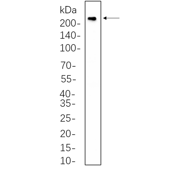 U-Blot® VEGF Receptor 2 Rabbit Monoclonal Antibody – Figure 1 of 1