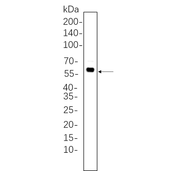 U-Blot® Akt (Phospho Thr308) Rabbit Monoclonal Antibody – Figure 1 of 1
