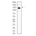 U-Blot® ULK1 Rabbit Monoclonal Antibody – Figure 1 of 1