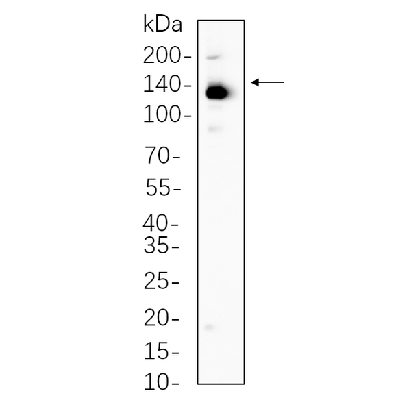 U-Blot® ULK1 Rabbit Monoclonal Antibody – Figure 1 of 1
