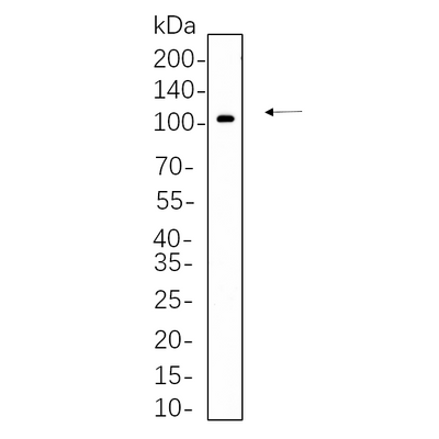 U-Blot® SATB2 Rabbit Monoclonal Antibody – Figure 1 of 1