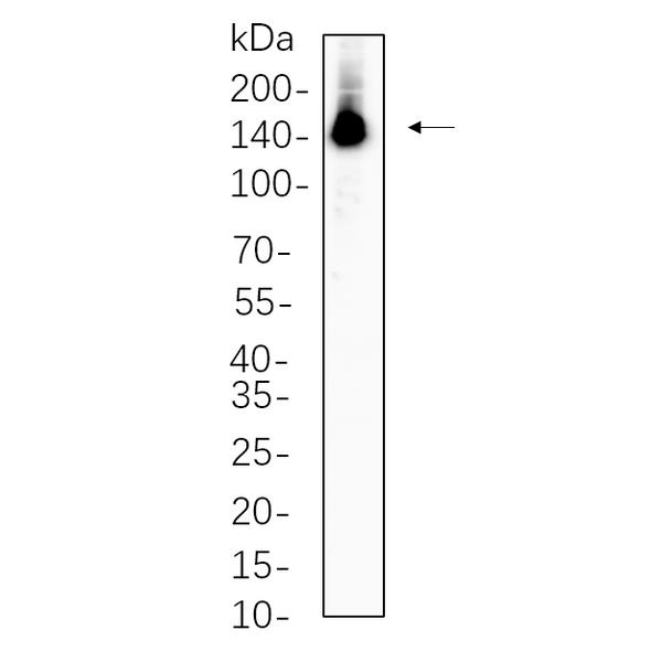 U-Blot® ULK1 (Phospho Ser757) Rabbit Monoclonal Antibody – Figure 1 of 1